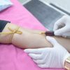 Blood Extraction Health Physical