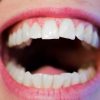 Teeth Mouth Woman